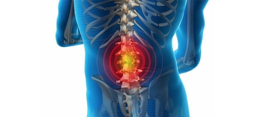 metódy diagnostiky bolesti chrbta